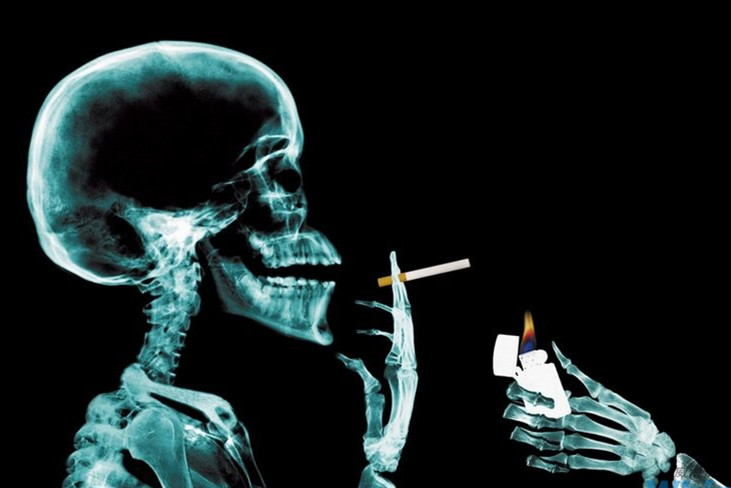 60岁50年烟龄患者突然戒烟的3大反应