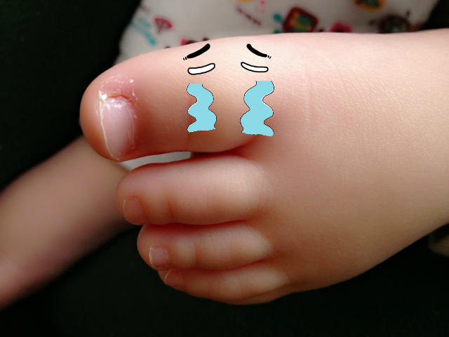 3岁前宝宝指甲不能乱剪,问题可大可小