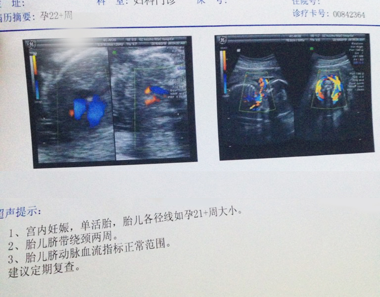 胎儿颈部w型压迹图片图片