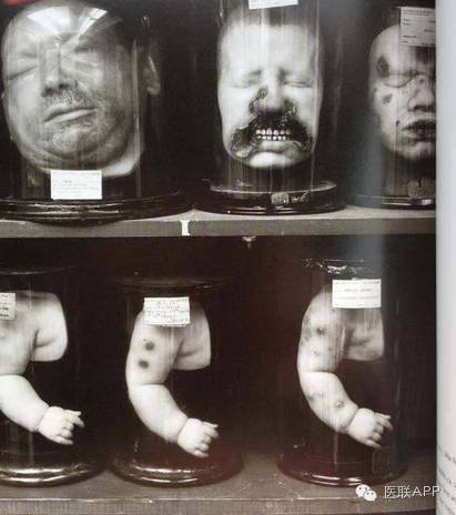 中国畸形婴儿博物馆图片