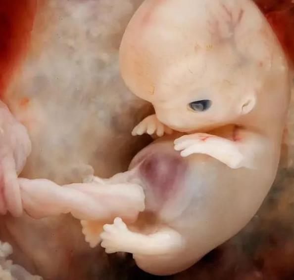 教体艺:三个月的胎儿的b超照,如此清晰!震撼