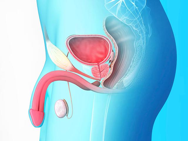 误解四:输精管切除会引起前列腺癌有段时间输精管切除会被认为提升