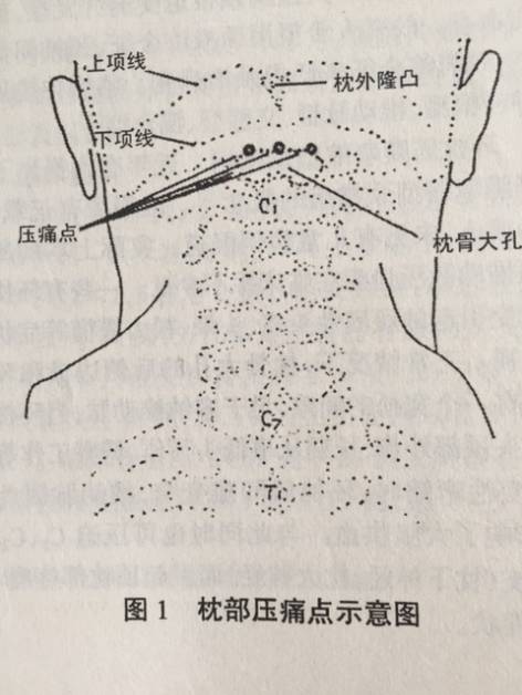 颈椎x线片检查多数无异常发现,部分生理曲度变直,反弓,棘突迹线偏歪