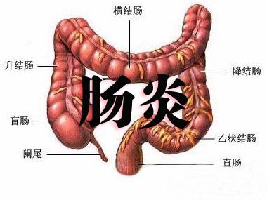 慢性肠炎的具体症状有什么