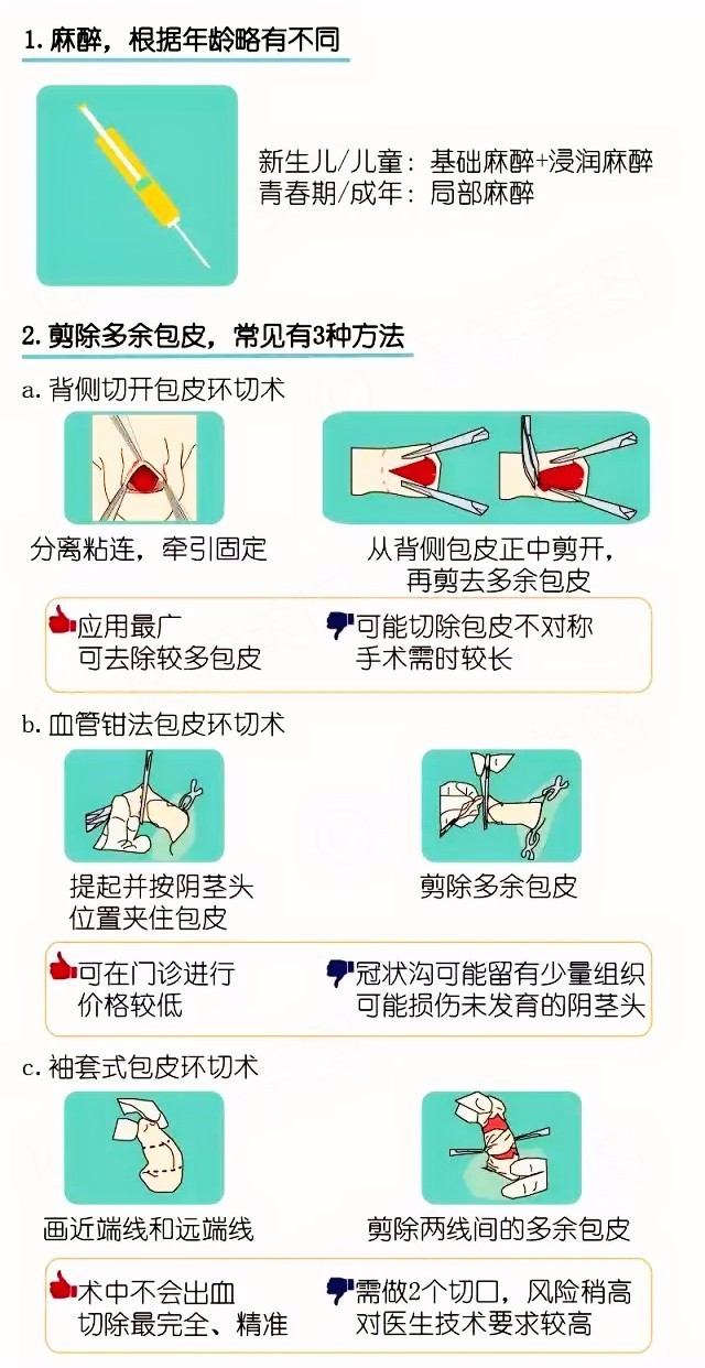 韩式割包茎过程图片图片
