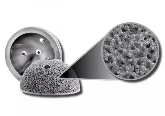 国内3d打印关节植入物研发成果举例