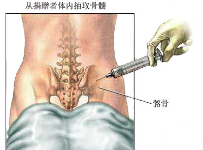 爸爸给了我一条命,我也要再给我爸一条命