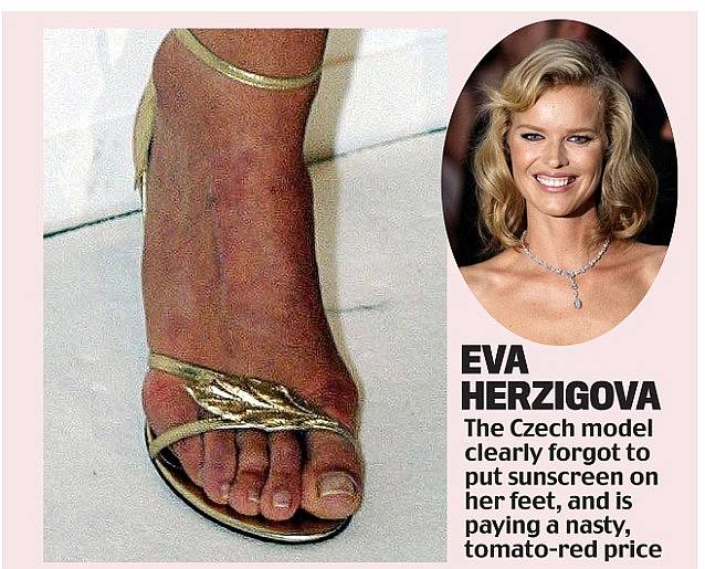 另外,她还是传说中的希腊脚,呃,看来希腊脚也不全是美女……▲瑞秋