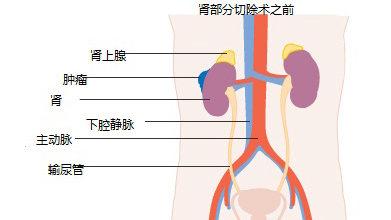 肾单位是组成肾脏的结构和功能的基本单位,每个肾脏约有一百多万个肾