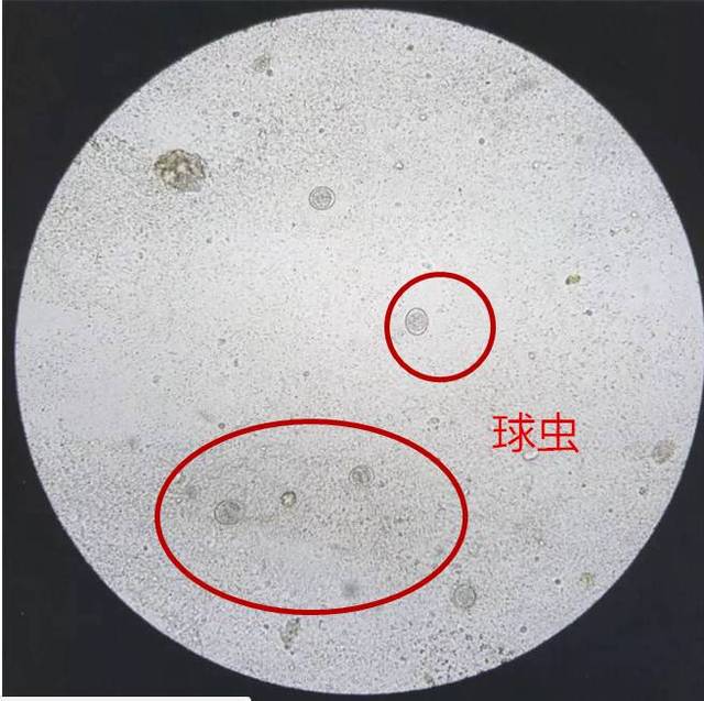鸡球虫显微镜图片