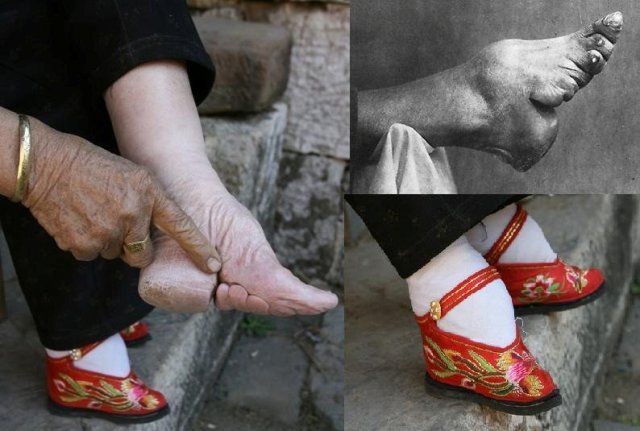 女子裹脚的起源图片