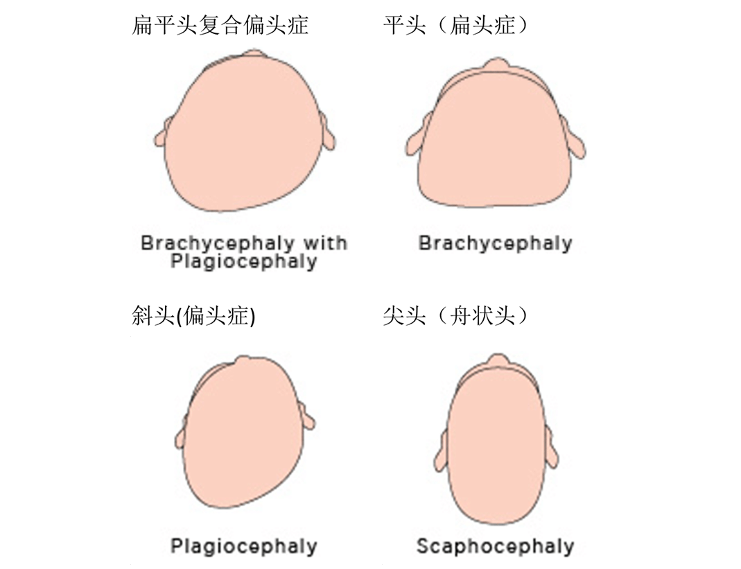 使得很多新生兒一出生就要被動的接受家人給寶寶