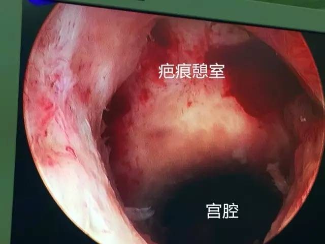 1分钟成功取出纱布,索赔300000块钱,滞留医院100800