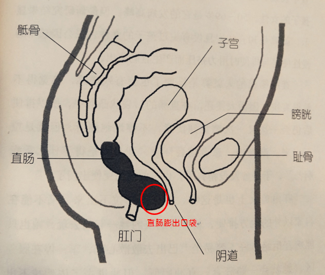 拉屎部位图片