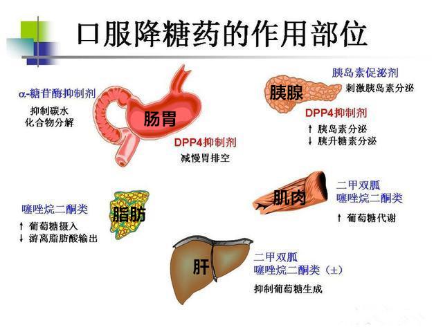 常用口服降糖药超级全不用担心医生不解释了