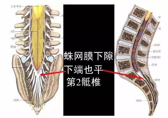 手把手教你小儿骶管阻滞麻醉