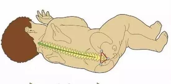 方法:从尾骨尖沿中线向头方向摸至2～6cm可触及一凹陷骶裂孔,在孔的