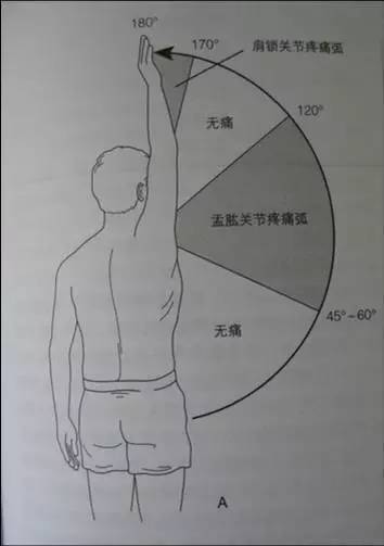 74jobe试验(倒罐头试验:患者上肢外展90,水平内收30,拇指向下