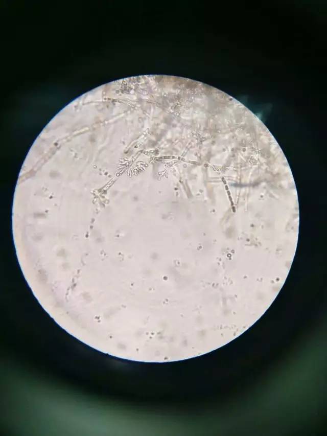 青霉的显微镜形态绘图图片