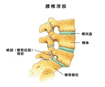 腰椎5位置真人图图片