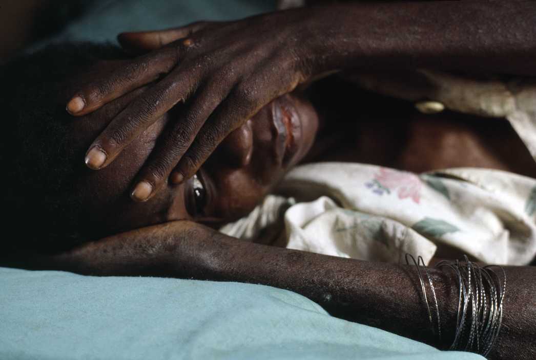 来到了艾滋病的重灾区之一的非洲乌干达,拍下了以下这组照片