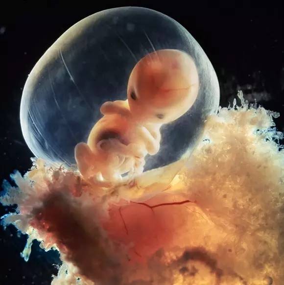 10周3天胎儿图片欣赏图片