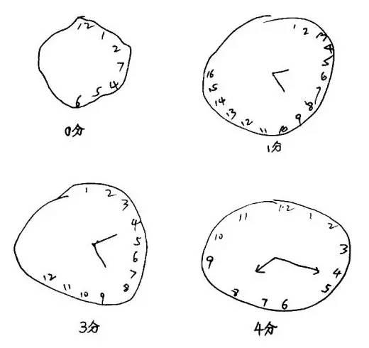 画钟表测试老年痴呆症图片