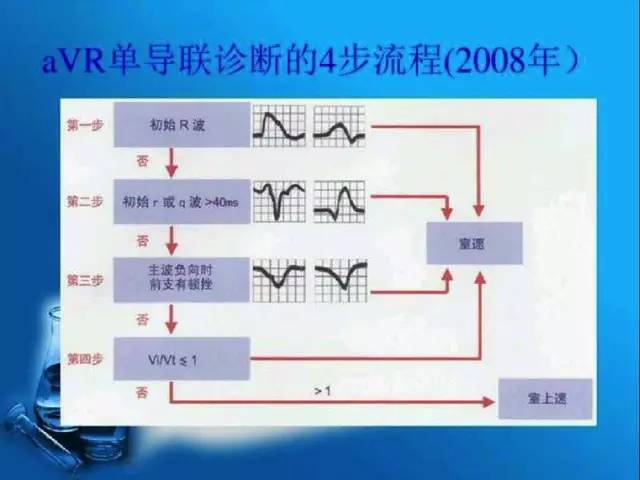 avr 四步法对于诊断的敏感率达 96.5,特异性为 75.