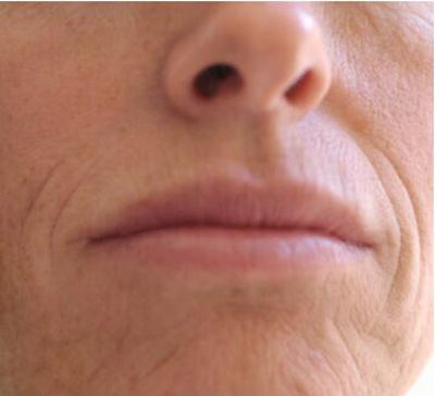 7,嘴唇嘴角出现细微的皱纹,表示你要多多补充铁质了!
