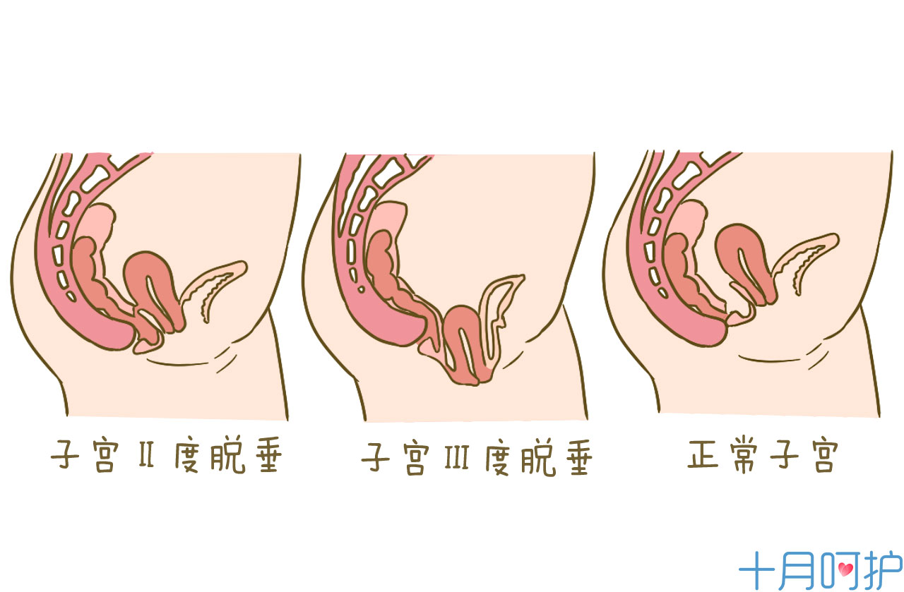 血管舒缩症状 绝经期综合征最突出的特征性症状