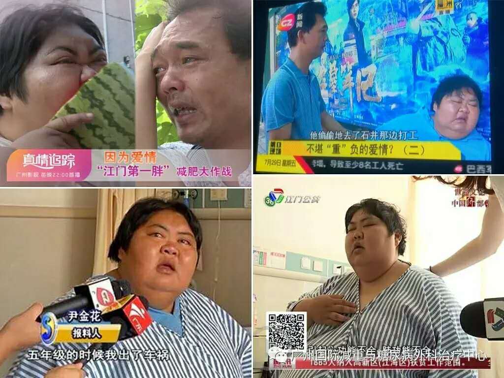 江门第一胖尹金花减肥记续4个月抛掉160斤