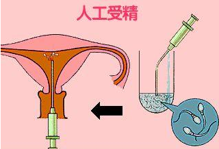 安全!人工助孕后多久能同房安安稳稳