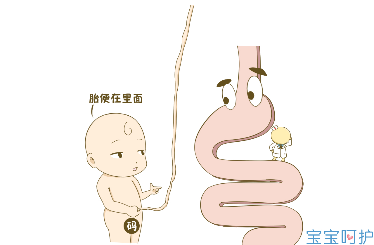 胎粪吸入综合征图片