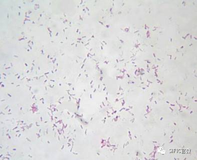 加德纳菌的典型图片图片
