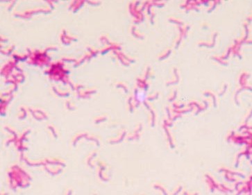 怎样预防幽门螺杆菌交叉感染