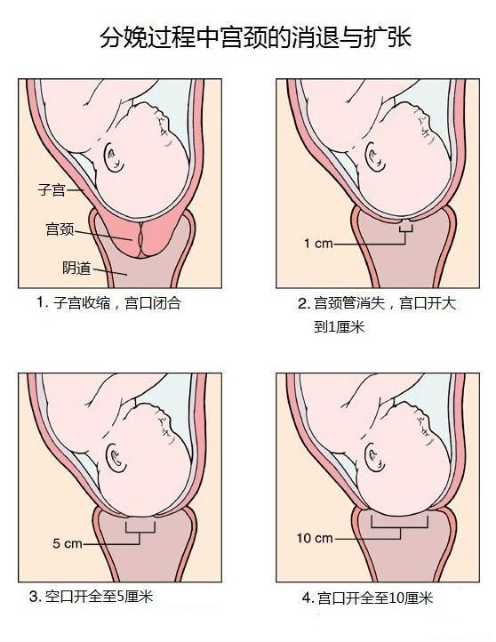 分娩中