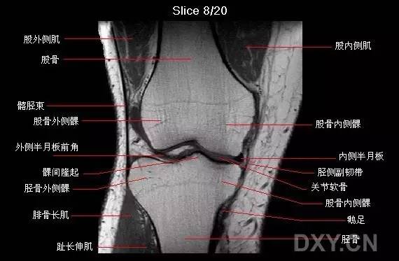 膝关节侧位片解剖图片