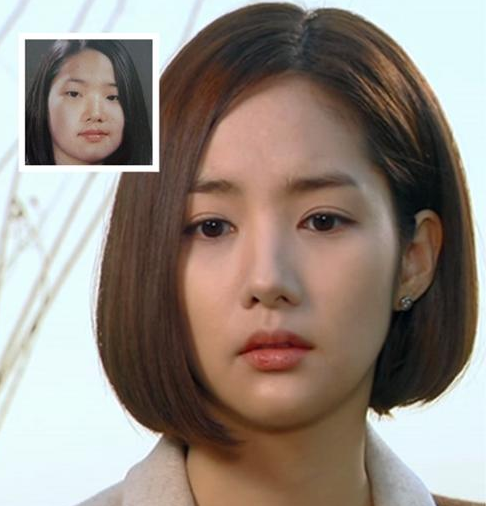 韩国女星整容成功典范图片
