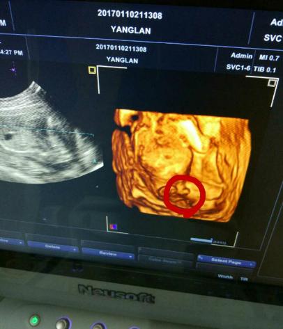 16周胎儿小鸡图片图片