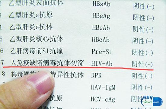 hiv检测报告单模板图片