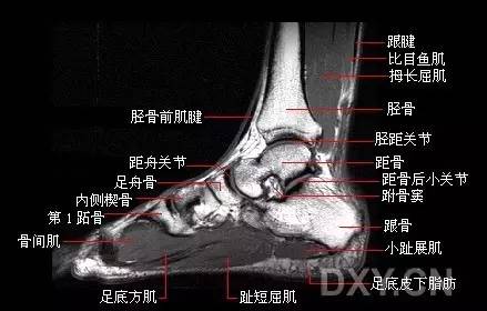 踝关节核磁解剖图图片