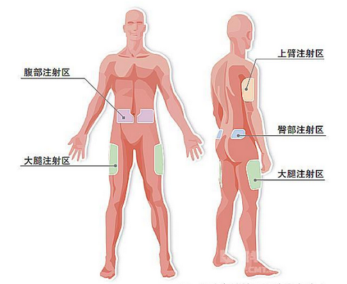 内分泌科主任刘龙诞介绍胰岛素