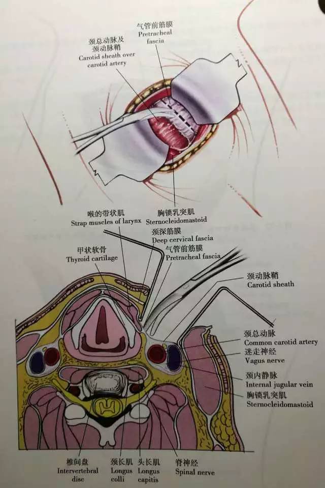 颈椎前路手术入路图解图片