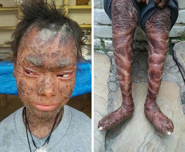 这印度蛇女每隔45天就脱皮一次,生活在痛苦中