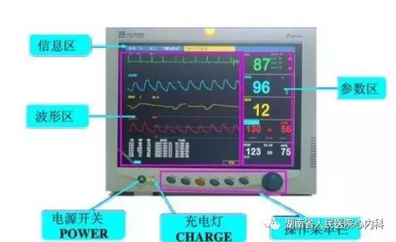 心電監護操作注意事項及常見報警處理,請收藏!