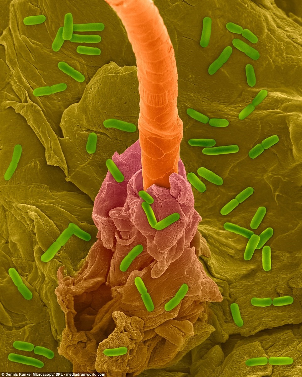 细菌的样子的图片图片