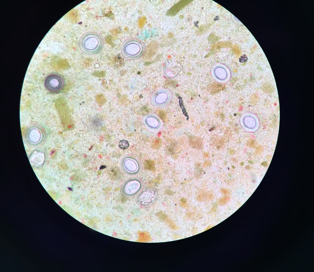 绦虫卵图片显微镜图片