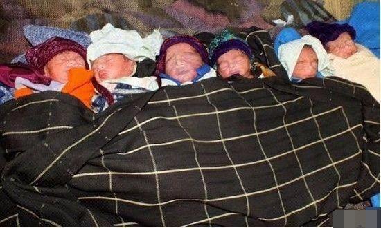 多胞胎分娩图片