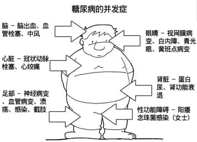 糖尿病的并发症有哪些后果很严重