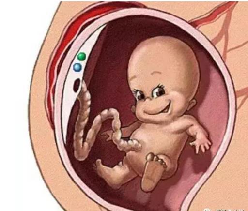 女人生完孩子胎盘图片图片